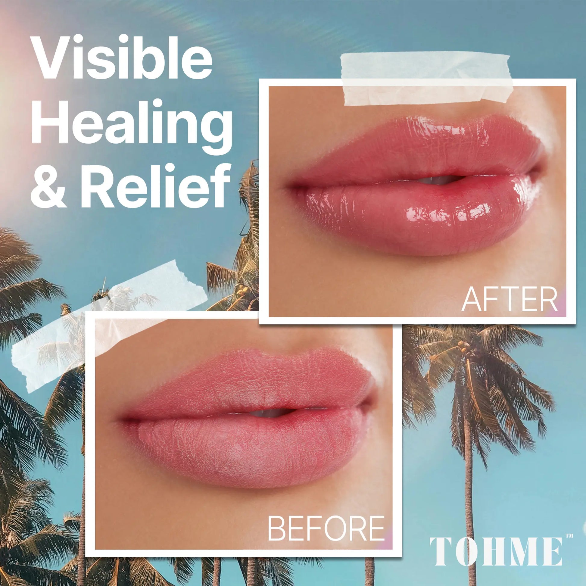 Nourishing Eczema Lip Balm with Ancient Mongongo Oil! Gentle, Hydrating Care for Dry, Cracked Lips—Perfect for Sensitive Skin. Moisture Skincare