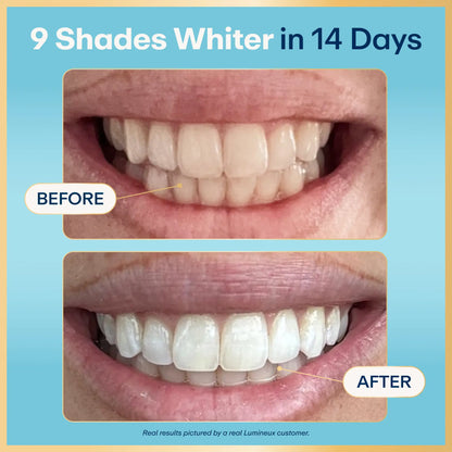 Lumineux Teeth Whitening Strips | 9 TREATMENTS | 18 STRIPS | Peroxide Free, Enamel Safe, Teeth Whitening for Sensitive Teeth | Sea Salt & Coconut Oil for Strong Healthy Teeth & Oral Care